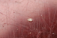 Acari Milben.JPG (843.14 KiB) 54056-mal betrachtet Acari Milben.JPG