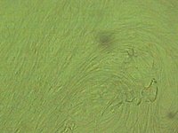 5-P. dives Gyne 3-09 Sperma x 40 web.jpg (37.28 KiB) 40873-mal betrachtet 5-P. dives Gyne 3-09 Sperma x 40 web.jpg